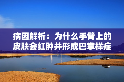 病因解析：為什么手臂上的皮膚會(huì)紅腫并形成巴掌樣癥狀？